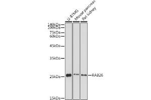 Western blot analysis of extracts of various cell lines, using R antibody (ABIN7269802) at 1:1000 dilution. (RAB26 Antikörper  (AA 1-60))