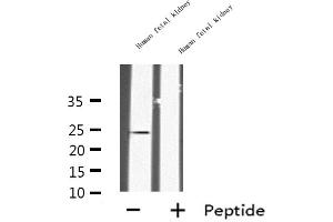 Western blot analysis of INSL6 expression in Human fetal kidney lysate,The lane on the left is treated with the antigen-specific peptide. (INSL6 Antikörper  (Internal Region))
