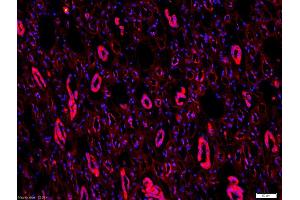 Formalin-fixed and paraffin-embedded human kidney labeled with Anti-CD54/ICAM-1 Polyclonal Antibody, Unconjugated (ABIN707651) 1:200, overnight at 4°C, The secondary antibody was Goat Anti-Rabbit IgG, Cy3 conjugated used at 1:200 dilution for 40 minutes at 37°C. (ICAM1 Antikörper  (AA 51-100))