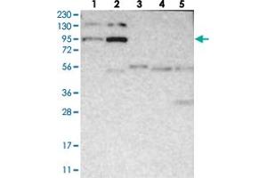 Western blot analysis of Lane 1: RT-4, Lane 2: U-251 MG, Lane 3: Human Plasma, Lane 4: Liver, Lane 5: Tonsil with FER polyclonal antibody  at 1:250-1:500 dilution. (FER Antikörper)