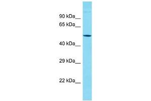 Host: Rabbit Target Name: KRT38 Sample Type: Jurkat Whole Cell lysates Antibody Dilution: 1. (KRT38 Antikörper  (N-Term))