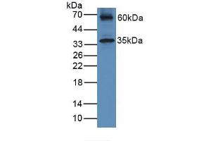 Figure. (HFE2 Antikörper  (AA 41-386))