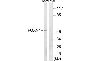 Western blot analysis of extracts from LOVO cells, using FOXN4 antibody. (FOXN4 Antikörper  (Internal Region))