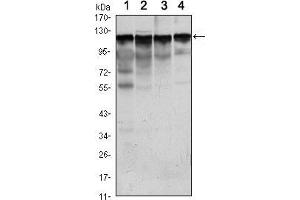 Western blot analysis using HK1 mouse mAb against Jurkat (1), Hela (2), HepG2 (3) and NIH/3T3 (4) cell lysate. (Hexokinase 1 Antikörper)