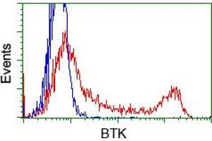 Image no. 1 for anti-Bruton Agammaglobulinemia tyrosine Kinase (BTK) antibody (ABIN1496975) (BTK Antikörper)
