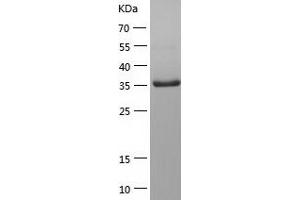 Western Blotting (WB) image for RNA Polymerase II CTD Repeat (AA 1586-1951) protein (His tag) (ABIN7124928) (RNA Polymerase II CTD Repeat (AA 1586-1951) protein (His tag))