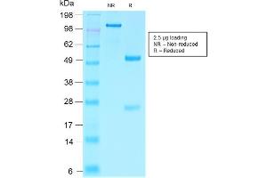 SDS-PAGE Analysis Purified Villin Rabbit Recombinant Monoclonal Antibody (VIL1/2310R). (Rekombinanter Villin 1 Antikörper  (AA 179-311))