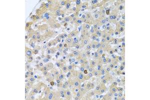Immunohistochemistry of paraffin-embedded human liver using APOA5 antibody at dilution of 1:100 (40x lens). (APOA5 Antikörper)