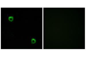 Immunofluorescence analysis of MCF-7 cells, using FZD2 antibody.