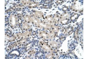 SNRP70 antibody was used for immunohistochemistry at a concentration of 4-8 ug/ml to stain Epithelial cells of renal tubule (arrows) in Human Kidney. (SNRNP70 Antikörper)