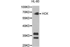 Western blot analysis of extracts of HL-60 cell lines, using HCK antibody. (HCK Antikörper)