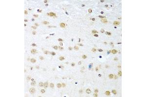 Immunohistochemistry of paraffin-embedded mouse brain using CCND2 antibody at dilution of 1:100 (40x lens). (Cyclin D2 Antikörper)