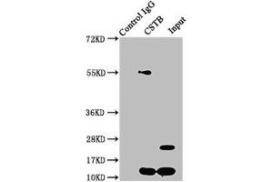 Immunoprecipitating CSTB in HepG2 whole cell lysate Lane 1: Rabbit control IgG instead of ABIN7148987 in HepG2 whole cell lysate. (CSTB Antikörper  (AA 1-98))