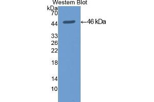 Detection of Recombinant KRT19, Mouse using Polyclonal Antibody to Cytokeratin 19 (CK19) (Cytokeratin 19 Antikörper  (AA 1-403))