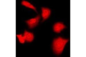 Immunofluorescent analysis of PKA C alpha/beta staining in Raw264. (PKA/C alpha/beta (N-Term) Antikörper)
