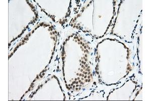 Immunohistochemical staining of paraffin-embedded Human colon tissue using anti-EIF2S1 mouse monoclonal antibody. (EIF2S1 Antikörper)