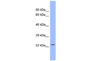 WB Suggested Anti-AK3L1 Antibody Titration:  0.