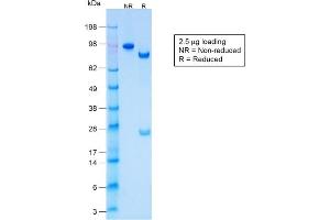 SDS-PAGE Analysis Purified CK LMW Rabbit Recombinant Monoclonal Antibody (KRTL/1577R).