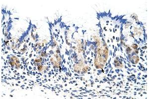 TROVE2 antibody was used for immunohistochemistry at a concentration of 4-8 ug/ml to stain Epithelial cells of fundic gland (arrows) in Human Stomach. (TROVE2 Antikörper  (N-Term))