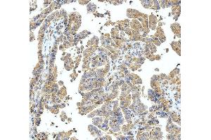 anti-Abl-Interactor 1 (ABI1) (AA 151-175), (N-Term) antibody