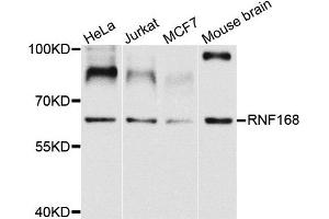 Western blot analysis of extracts of various cells, using RNF168 antibody. (RNF168 Antikörper)