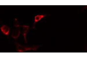 ABIN6275486 staining Hela cells by IF/ICC. (ALDH1A2 Antikörper  (C-Term))