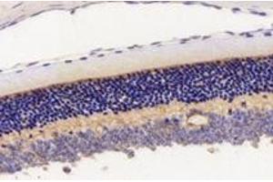 Immunohistochemistry analysis of paraffin-embedded mouse eyeball using,KCNV2 (ABIN7075150) at dilution of 1: 2800 (KCNV2 Antikörper)