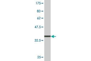 Western Blot detection against Immunogen (35. (ACTRT2 Antikörper  (AA 209-299))