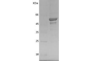 Western Blotting (WB) image for Toll Interacting Protein (TOLLIP) (AA 2-274) protein (GST tag) (ABIN7125410) (TOLLIP Protein (AA 2-274) (GST tag))