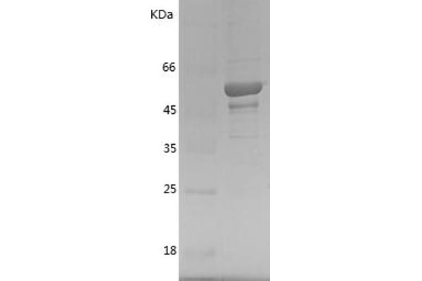 TOLLIP Protein (AA 2-274) (GST tag)