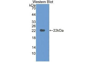 Western blot analysis of the recombinant protein. (M6PR Antikörper  (AA 27-185))