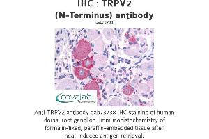 Image no. 1 for anti-Transient Receptor Potential Cation Channel, Subfamily V, Member 2 (TRPV2) (N-Term) antibody (ABIN1740404)