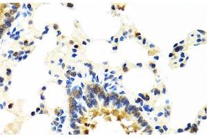 Immunohistochemistry of paraffin-embedded Rat lung using CRTAP Polyclonal Antibody at dilution of 1:100 (40x lens). (CRTAP Antikörper)
