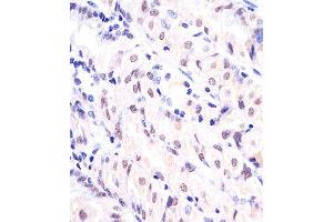 Immunohistochemistry (Paraffin-embedded Sections) (IHC (p)) image for anti-Apurinic/Apyrimidinic Endonuclease 1 (APEX1) antibody (ABIN4906178)