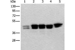 Western blot analysis of 293T Hela and HEPG2 cell lysates using TIA1 Polyclonal Antibody at dilution of 1:250 (TIA1 Antikörper)