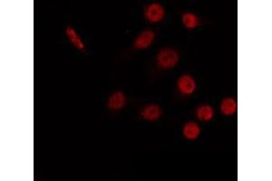 ABIN6266765 staining 293 by IF/ICC. (CBX6 Antikörper  (N-Term))