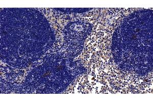 Immunohistochemistry (IHC) image for anti-Interleukin 1 Receptor, Type I (IL1R1) (AA 226-352) antibody (ABIN7438886)