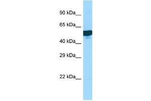 WB Suggested Anti-C1RL Antibody Titration: 1. (C1RL Antikörper  (Middle Region))