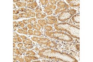 IHC analysis of Occludin/OCLN using anti-Occludin/OCLN antibody (ABIN7601995). (Occludin Antikörper  (AA 54-270))
