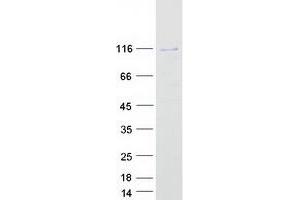 Six5 Protein (Myc-DYKDDDDK Tag)