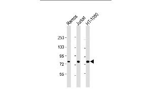 All lanes : Anti-GARS Antibody at 1:4000 dilution Lane 1: Ramos whole cell lysate Lane 2: Jurkat whole cell lysate Lane 3: HT-1080 whole cell lysate Lysates/proteins at 20 μg per lane. (GARS Antikörper  (AA 35-305))