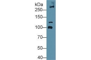 Western blot analysis of Mouse Bladder lysate, using Mouse COL6a3 Antibody (1 µg/ml) and HRP-conjugated Goat Anti-Rabbit antibody ( (COL6a3 Antikörper  (AA 2009-2205))