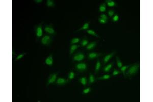 Immunofluorescence analysis of U2OS cells using SSRP1 antibody (ABIN6129537, ABIN6148493, ABIN6148495 and ABIN6222048). (SSRP1 Antikörper  (AA 1-300))