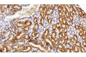 Detection of CAT in Mouse Kidney Tissue using Polyclonal Antibody to Catalase (CAT) (Catalase Antikörper  (AA 401-523))
