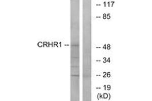 Western blot analysis of extracts from HT-29/LOVO cells, using CRHR1 Antibody. (CRHR1 Antikörper  (AA 75-124))