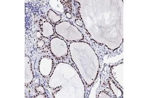Immunohistochemical staining of human thyroid gland with POFUT2 polyclonal antibody ( Cat # PAB28284 ) shows moderate nuclear positivity in glandular cells at 1:20 - 1:50 dilution. (POFUT2 Antikörper)