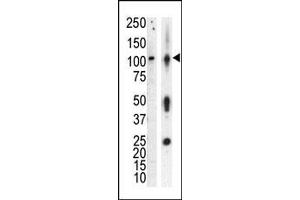 Western blot analysis of anti-PKCnu Pab in lysate of HL60 cells stimulated with PMA (lane A) and mouse brain tissue lysate (lane B).