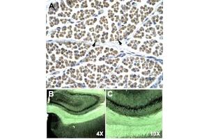 Immunohistochemical staining (Formalin-fixed paraffin-embedded sections) of human muscle (A) and rat brain (B, C) with GABRD polyclonal antibody . (GABRD Antikörper  (N-Term))