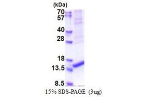 ARMS2 Protein (AA 1-107) (His tag)