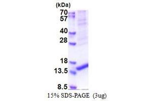 SDS-PAGE (SDS) image for Age-Related Maculopathy Susceptibility 2 (ARMS2) (AA 1-107) protein (His tag) (ABIN6387354) (ARMS2 Protein (AA 1-107) (His tag))